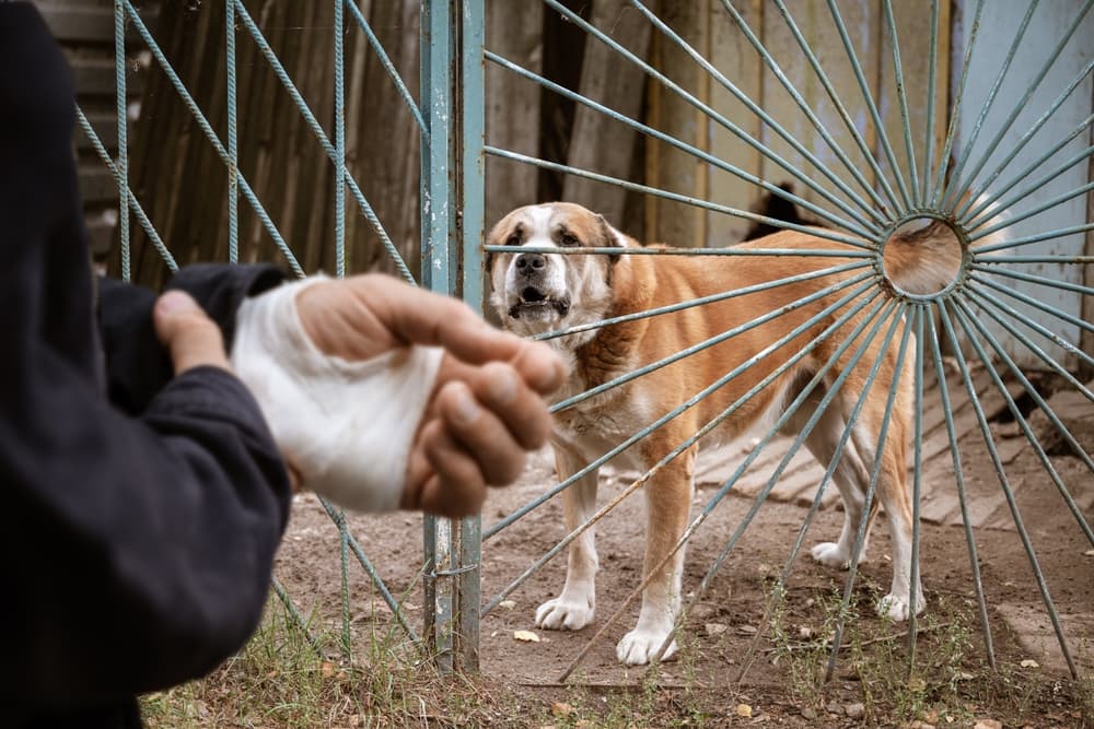 A male Alabai dog bit a man's hand. The man's hand is now bandaged. This highlights the importance of animal care and rabies prevention.








