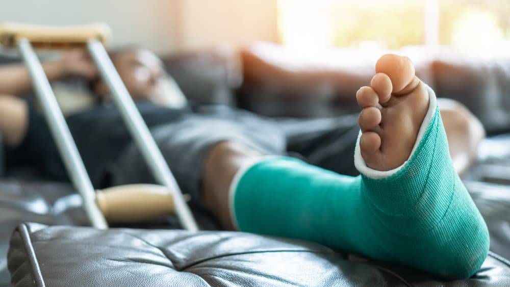 Male patient with a foot and leg bone fracture, using a splint cast and crutches, lying on a couch during surgery rehabilitation and orthopedic recovery at home.